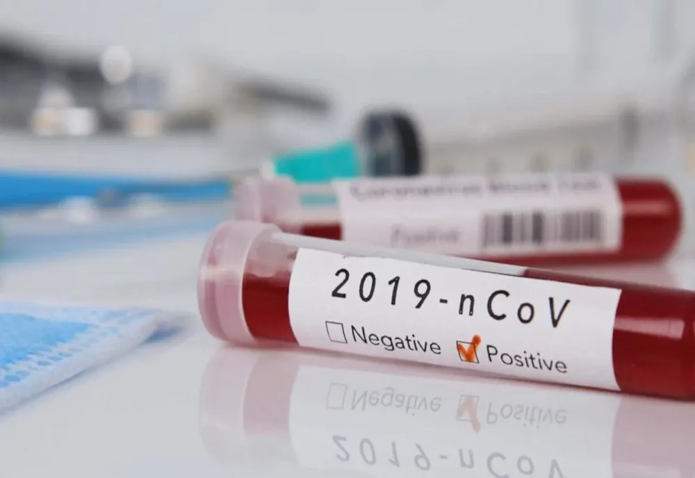 CORONAVIRUS: Situația în Neamț și în țară (date oficiale)