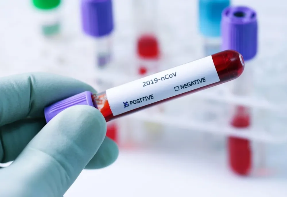 Bilanț coronavirus 18 octombrie: 10.141 cazuri noi de persoane infectate cu COVID în ultimele 24 de ore