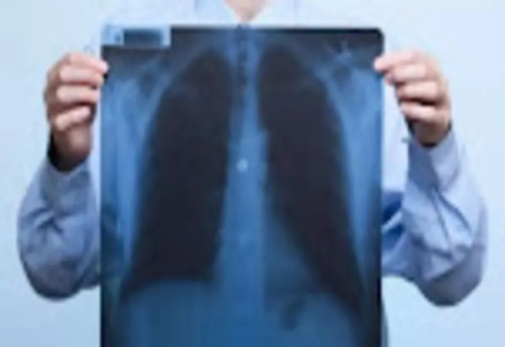 Cum arată plămânii unui pacient nevaccinat, bolnav de COVID - Medicii, îngroziți de imagini! - FOTO șocant în articol
