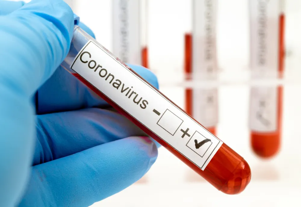 Bilanț coronavirus 10 ianuarie: 4.104 cazuri noi și 16 decese