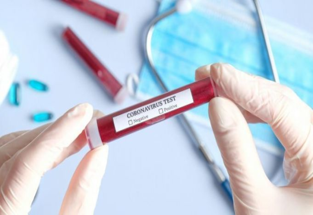 Bilant coronavirus ROMÂNIA, 26 iulie. 1120 de cazuri noi în ultimele 24 de ore și 22 de decese