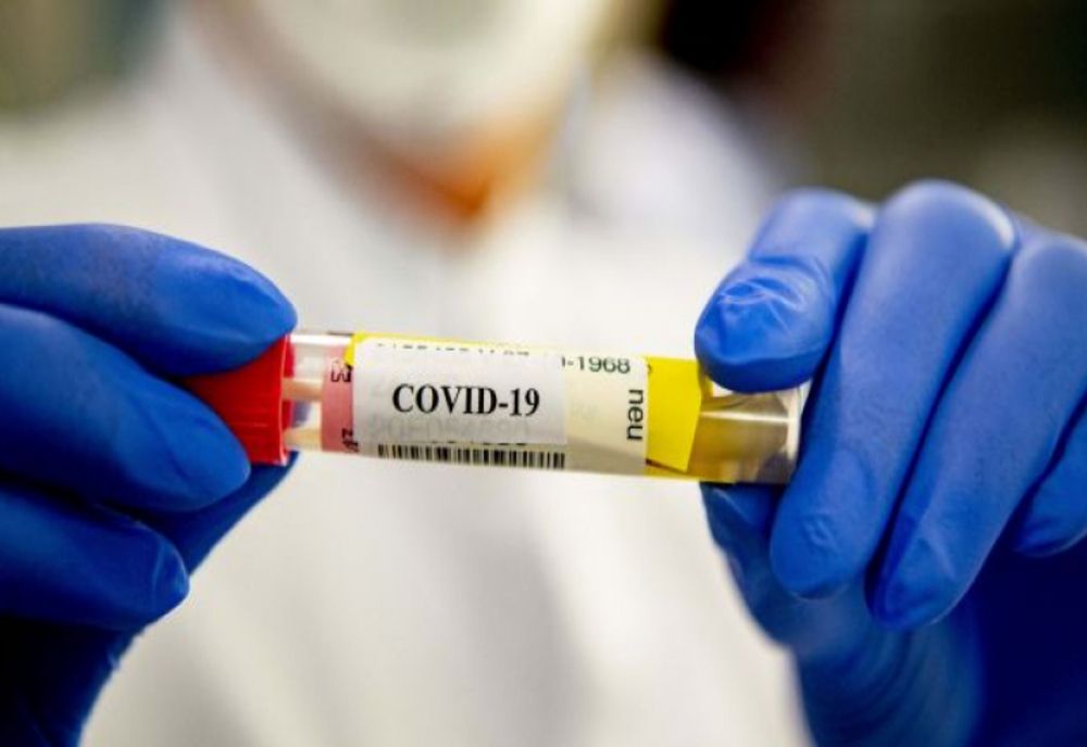 Bilanț coronavirus 22 noiembrie: 1.550 de cazuri noi, 154 decese dintre care 29 anterioare