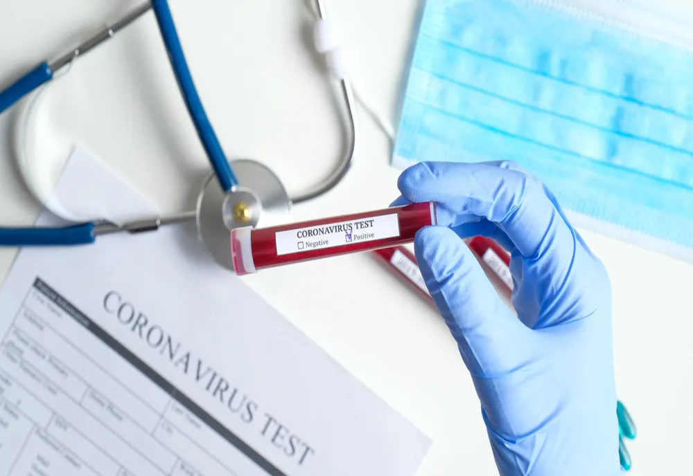 Bilanț coronavirus 3 februarie: 32.671 cazuri noi și 111 decese