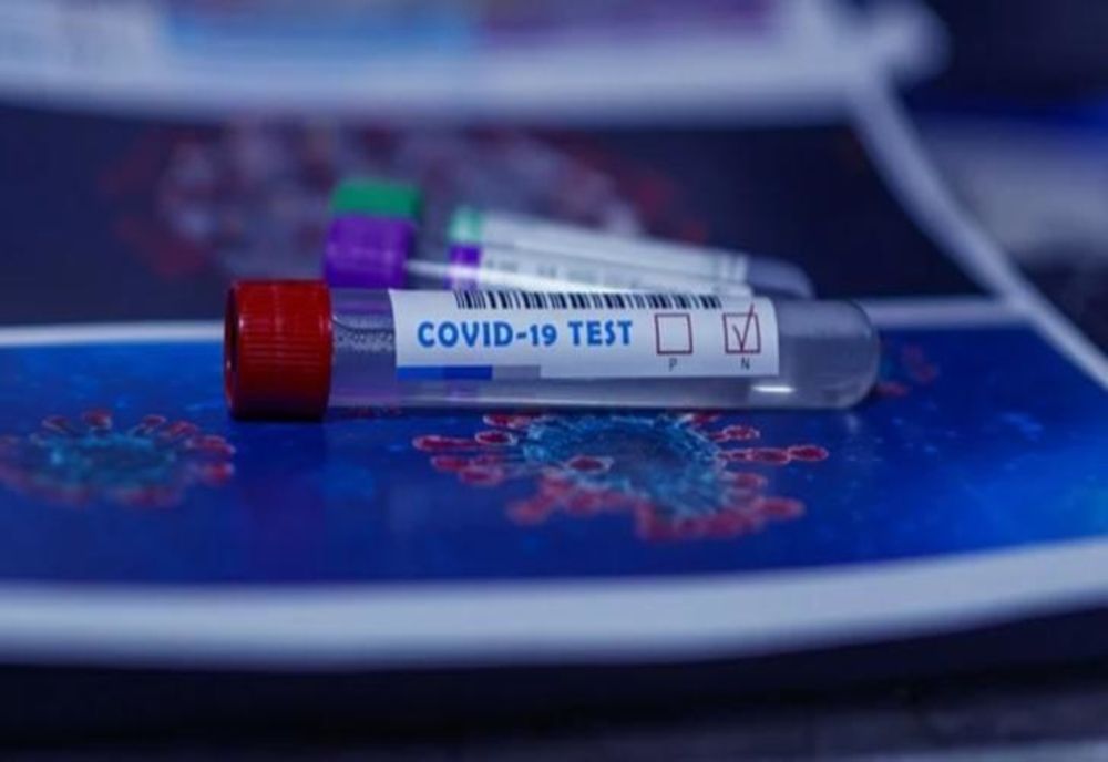 A început testarea națională anti-COVID-19 în România! Care sunt primele județele vizate