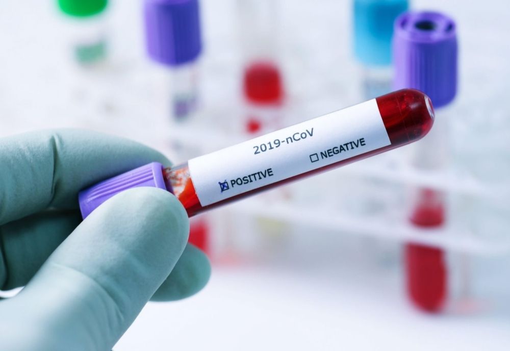 Bilanț coronavirus 06 decembrie 2021: 803 cazuri noi și 54 decese
