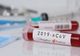 CORONAVIRUS: Situația în Neamț și în țară (date oficiale)