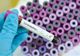 Bilanț coronavirus: 825 de cazuri noi și 37 de decese