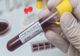 Bilanț coronavirus 28 august: 1.318 cazuri noi, 48 de decese și 497 persoane internate la Terapie Intensivă